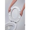 Frogee Duroplast WC ülőke - Lecsapódásmentes zsanérokkal - Fehér